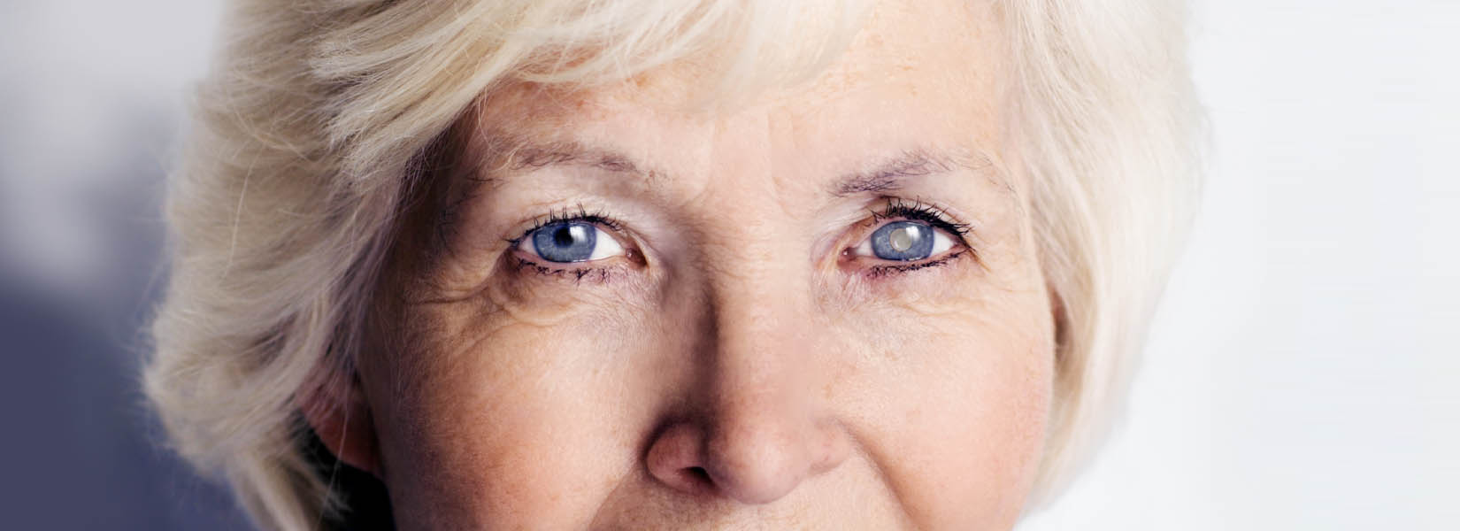 Cataract Surgery in Original Town North